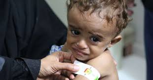 Five Million Yemeni Children may face femine