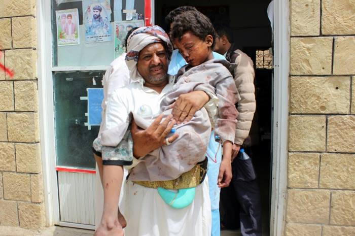 yemen bus AFP / STRINGERA man transports a child to a hospital after he was wounded in a reported air strike in Saada on August 9, 2018