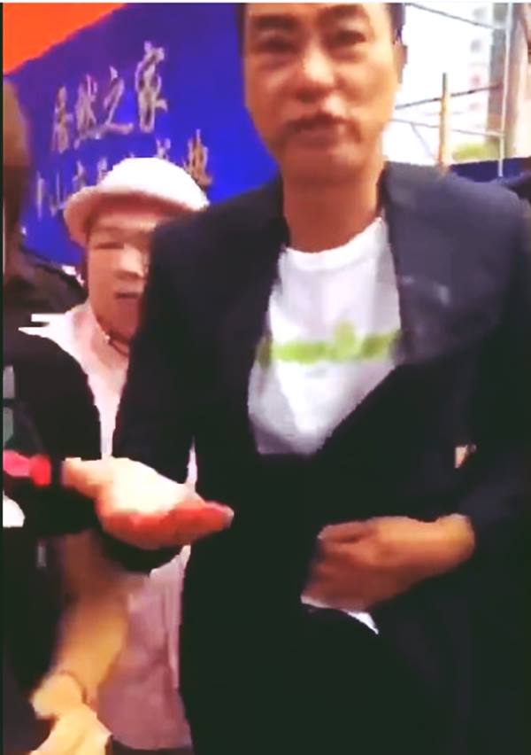 Simon Yam Holding his stomach after attack 