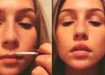 Superglueing Lips : A Foolish New Beauty Trend