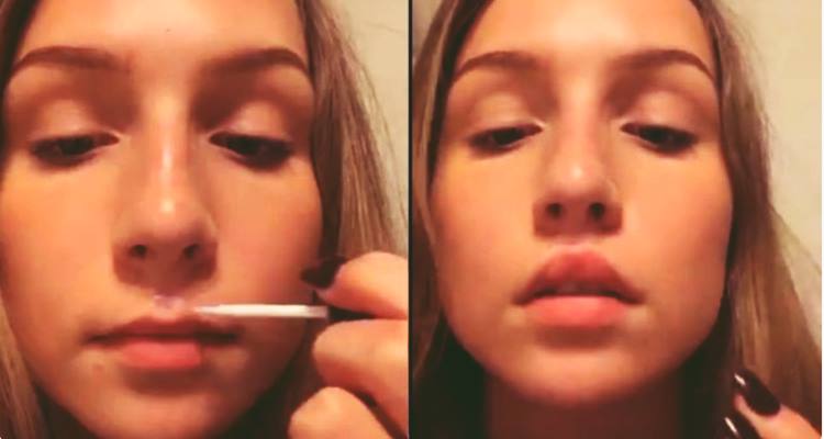 Superglueing Lips : A Foolish New Beauty Trend